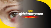 आँखों की पलकों में फुंसी (Guheri) को ठीक करने के आसान घरेलू उपाय !